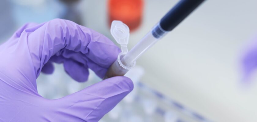 un specialist analizeaza o mostra de fecale in laborator