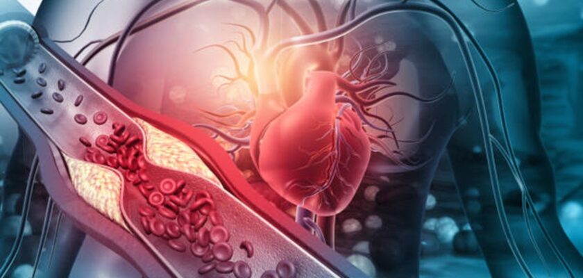 Colesterolul redus într-o săptămână. Cinci pași recomandați de nutriționiști